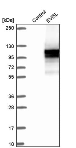 EVI5L Antibody, Novus Biologicals 25 &mu;L; Unlabeled:Antibodies, Polyclonal